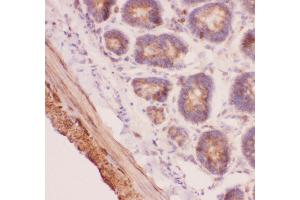 Anti-Angiopoietin 2 Picoband antibody,  IHC(P): Rat Intestine Tissue (Angiopoietin 2 抗体  (AA 19-348))