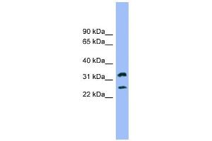 FCER1A antibody used at 1 ug/ml to detect target protein. (Fc epsilon RI/FCER1A 抗体  (N-Term))