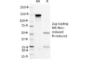 SDS-PAGE Analysis Purified CD36 Mouse Monoclonal Antibody (1E8). (CD36 抗体)