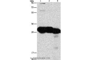 Western blot analysis of Mouse liver and kidney tissue, human fetal liver tissue, using KHK Polyclonal Antibody at dilution of 1:1350 (Ketohexokinase 抗体)