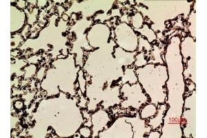 Immunohistochemical analysis of paraffin-embedded rat-lung, antibody was diluted at 1:100. (NRF2 抗体  (acLys599))