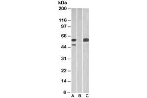 Western blot testing of HEK293 lysate overexpressing human TRIM21 with MYC tag with TRIM21 antibody [1ug/ml] in Lane A and probed with anti-MYC tag [1/1000] in lane C. (TRIM21 抗体)