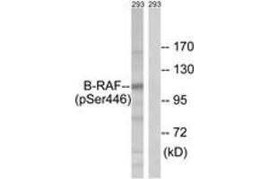 Western blot analysis of extracts from 293 cells treated with EGF 200ng/ml 30', using B-RAF (Phospho-Ser446) Antibody. (SNRPE 抗体  (pSer446))