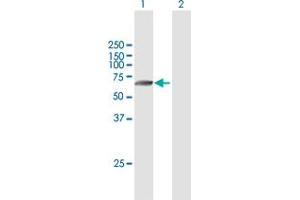 Western Blot analysis of TMPRSS6 expression in transfected 293T cell line by TMPRSS6 MaxPab polyclonal antibody. (TMPRSS6 抗体  (AA 1-461))
