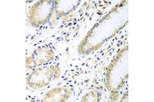 Immunohistochemistry of paraffin-embedded human stomach using IL5 antibody (ABIN5975164) at dilution of 1/100 (40x lens). (IL-5 抗体)