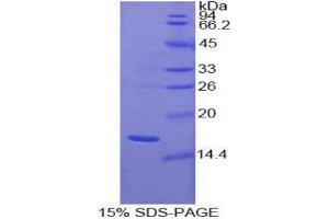 SDS-PAGE (SDS) image for Glial Cell Line Derived Neurotrophic Factor (GDNF) (AA 78-211) protein (His tag) (ABIN1079640) (GDNF Protein (AA 78-211) (His tag))