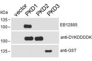 Western Blotting (WB) image for anti-Protein Kinase D1 (PRKD1) (AA 233-246) antibody (ABIN5874190) (PKC mu 抗体  (AA 233-246))