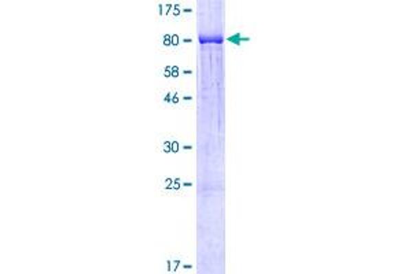 PFKFB3 Protein (AA 1-520) (GST tag)