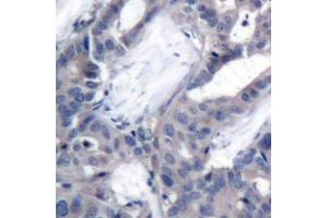 Immunohistochemistry (IHC) image for anti-Mitogen-Activated Protein Kinase Kinase 2 (MAP2K2) (pThr394) antibody (ABIN1870344) (MEK2 抗体  (pThr394))