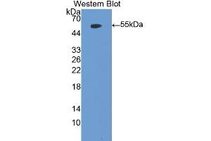 Western blot analysis of the recombinant protein. (Myeloperoxidase 抗体  (AA 253-718))