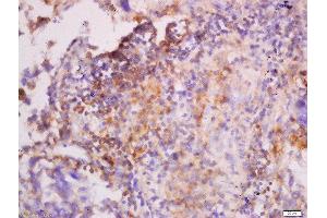 Immunohistochemistry (Paraffin-embedded Sections) (IHC (p)) image for anti-Keratin 7 (KRT7) (AA 251-350) antibody (ABIN732023)