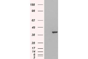 Western Blotting (WB) image for anti-GRB2-Related Adaptor Protein 2 (GRAP2) antibody (ABIN5901198) (GRAP2 抗体)