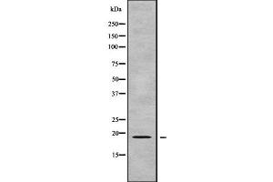 Western blot analysis GPSM3 using COLO205 whole cell lysates (GPSM3 抗体  (C-Term))