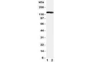 Western blot testing of COL2A1 antibody and Lane 1:  rat heart (COL2A1 抗体  (C-Term))