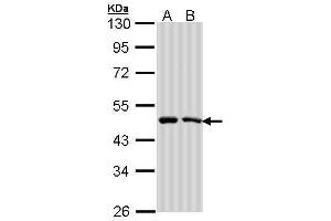 WB Image Sample (30 ug of whole cell lysate) A: A431 , B: H1299 10% SDS PAGE antibody diluted at 1:1000 (SIL1 抗体  (C-Term))