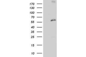 Western Blotting (WB) image for anti-Proteasome (Prosome, Macropain) 26S Subunit, Non-ATPase, 3 (PSMD3) antibody (ABIN1499979) (PSMD3 抗体)