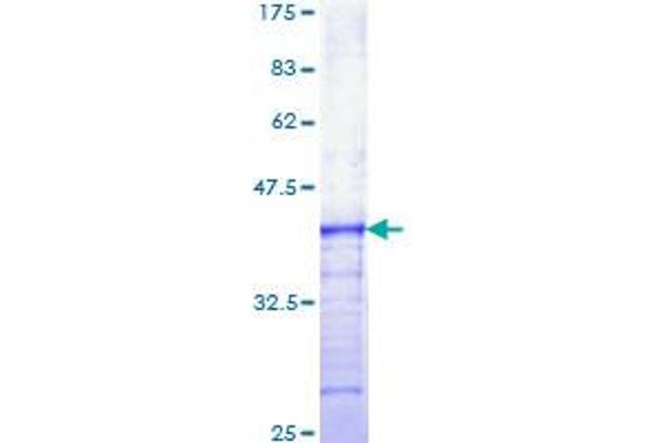 FGFR3 Protein (AA 27-126) (GST tag)