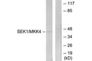 Western blot analysis of extracts from NIH-3T3 cells, using SEK1/MKK4 (Ab-80) Antibody. (MAP2K4 抗体  (AA 46-95))
