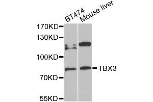 Western blot analysis of extracts of various cell lines, using TBX3 antibody (ABIN5972282) at 1/1000 dilution. (TBX3 抗体)