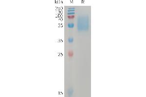 ACVR1C/ALK7 Protein (AA 22-113) (Fc Tag)