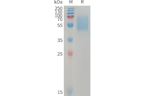 ACVR1C/ALK7 Protein (AA 22-113) (Fc Tag)