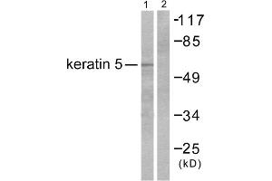 Western blot analysis of extracts from HepG2 cells, using Keratin 5 antibody (ABIN5976441). (Cytokeratin 5 抗体  (C-Term))