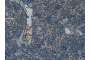 IHC-P analysis of Rat Spleen Tissue, with DAB staining. (FGFRL1 抗体  (AA 164-368))