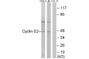 Immunohistochemistry analysis of paraffin-embedded human thyroid gland tissue using Cyclin(Ab-392) antibody. (Cyclin E2 抗体)