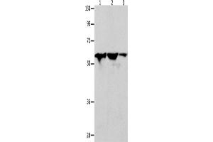 Western Blotting (WB) image for anti-DnaJ (Hsp40) Homolog, Subfamily C, Member 7 (DNAJC7) antibody (ABIN2428529) (DNAJC7 抗体)