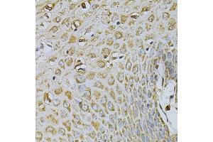 Immunohistochemistry of paraffin-embedded human esophagus using CDA Antibody (ABIN6291347) at dilution of 1:100 (40x lens). (CDA 抗体)