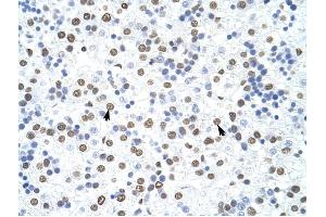 HNRPD antibody was used for immunohistochemistry at a concentration of 4-8 ug/ml to stain Hepatocytes (arrows) in Human Liver. (HNRNPD/AUF1 抗体)