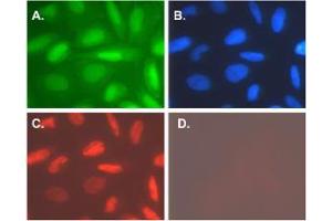 Immunofluorescence (IF) image for anti-Telomerase Reverse Transcriptase (TERT) (C-Term) antibody (ABIN6655122)