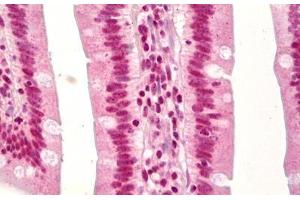 Anti-TP53 / p53 antibody IHC staining of human small intestine. (p53 抗体  (acLys379))