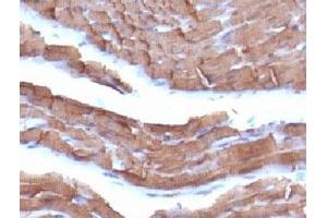 Immunohistochemistry (Formalin-fixed Paraffin-embedded Sections) (IHC (fp)) image for anti-Pan Muscle Actin antibody (ABIN3026683)