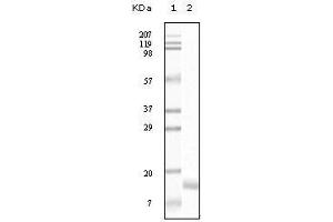 Western blot analysis using SNCG mouse mAb against truncated SNCG recombinant protein. (SNCG (Breast Cancer-Specific Protein 1) 抗体)