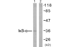 Western blot analysis of extracts from 293 cells untreated or treated with TNF-α (20ng/ml, 30min), using IκB-α (Ab-42) antibody (#B7116). (NFKBIA 抗体  (Tyr42))