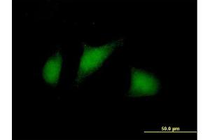 Immunofluorescence of purified MaxPab antibody to TSC22D1 on HeLa cell. (TSC22D1 抗体  (AA 1-144))