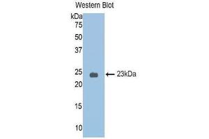 Western Blotting (WB) image for anti-serpin Peptidase Inhibitor, Clade A (Alpha-1 Antiproteinase, Antitrypsin), Member 6 (SERPINA6) (AA 25-195) antibody (ABIN1174369) (SERPINA6 抗体  (AA 25-195))