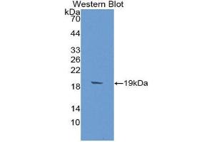 Western Blotting (WB) image for anti-alpha-2-Glycoprotein 1, Zinc-Binding (AZGP1) (AA 148-298) antibody (ABIN2117195) (AZGP1 抗体  (AA 148-298))