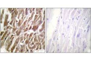 Immunohistochemistry analysis of paraffin-embedded human heart tissue, using TNNI3 (Ab-43) Antibody. (TNNI3 抗体  (AA 11-60))