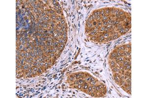 Immunohistochemistry (IHC) image for anti-Clusterin Associated Protein 1 (CLUAP1) antibody (ABIN2423174) (CLUAP1 抗体)