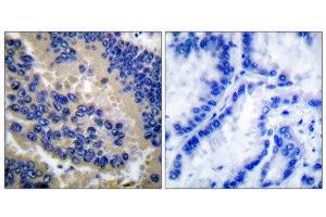 Immunohistochemistry (IHC) image for anti-Caspase 3 (CASP3) (Cleaved-Asp175) antibody (ABIN1853450) (Caspase 3 抗体  (Cleaved-Asp175))