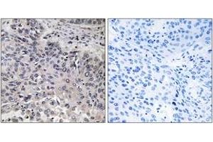 Immunohistochemistry (IHC) image for anti-Complement Component 1, Q Subcomponent, C Chain (C1QC) (AA 81-130) antibody (ABIN2890231) (C1QC 抗体  (AA 81-130))