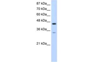 Western Blotting (WB) image for anti-Splicing Factor 3b, Subunit 4, 49kDa (SF3B4) antibody (ABIN2462194) (SF3B4 抗体)