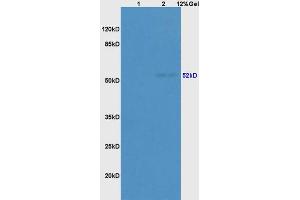 Lane 1: mouse embryo lysates Lane 2: rat brain lysates probed with Anti CK14/17/42/10 Polyclonal Antibody, Unconjugated (ABIN734498) at 1:200 in 4 °C. (pan Keratin 抗体)