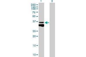 Western Blot analysis of CTSB expression in transfected 293T cell line by CTSB MaxPab polyclonal antibody. (Cathepsin B 抗体  (AA 1-339))