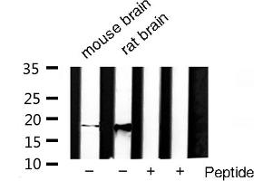 Western blot analysis of SOD1 Antibody expression in rat brain and mouse brain tissues lysates. (SOD1 抗体  (Internal Region))