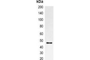 Immunoprecipitation of mOrange-tagged protein from HEK293T cells transfected with vector overexpressing mOrange tag, using Anti-mOrange-tag Antibody. (mOrange Fluorescent Protein 抗体)