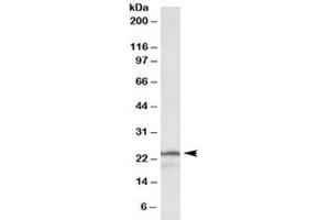 Western blot testing of K562 lysate with PSMB3 antibody at 1ug/ml. (PSMB3 抗体)