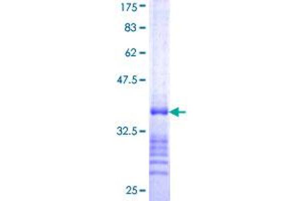 SOX2 Protein (AA 155-245) (GST tag)